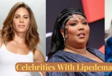 Celebrities with Lipedema