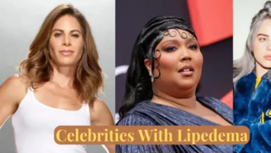 Celebrities with Lipedema