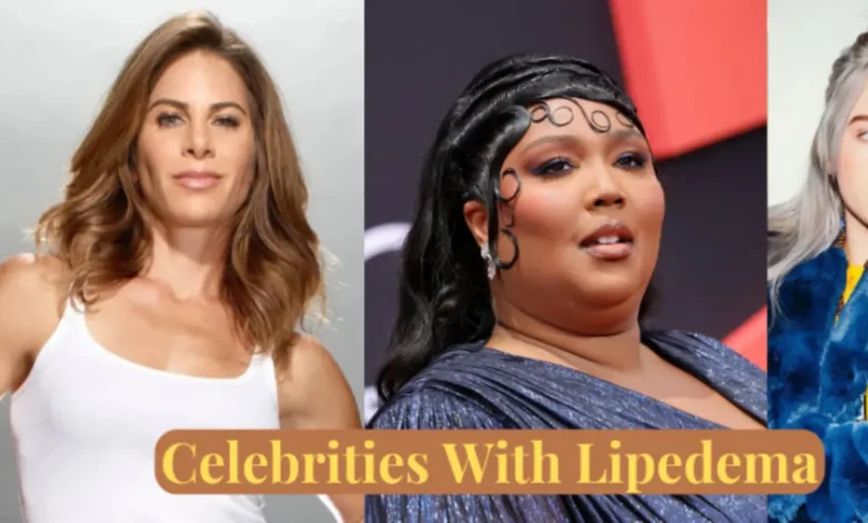 Celebrities with Lipedema