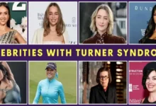 Celebrities with Turner Syndrome