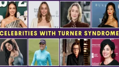 Celebrities with Turner Syndrome