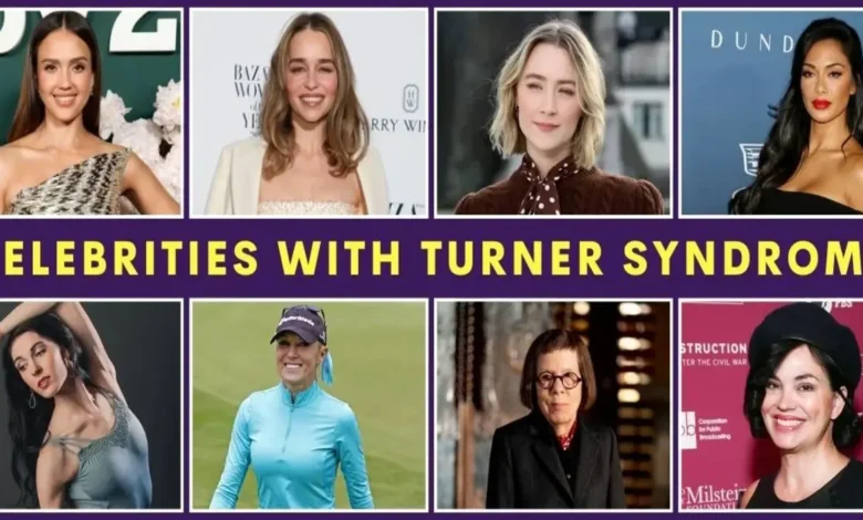 Celebrities with Turner Syndrome