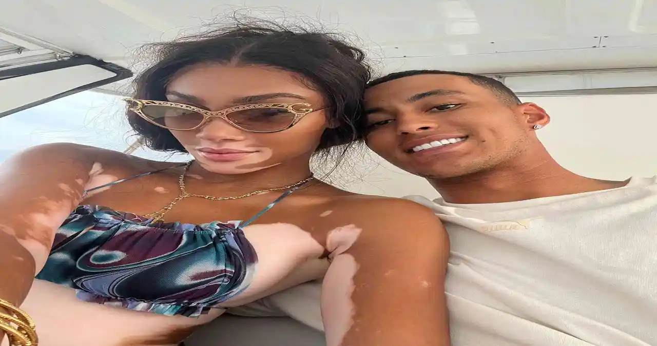 Winnie Harlow Boyfriend: A Deep Dive Into Her Relationship Journey1